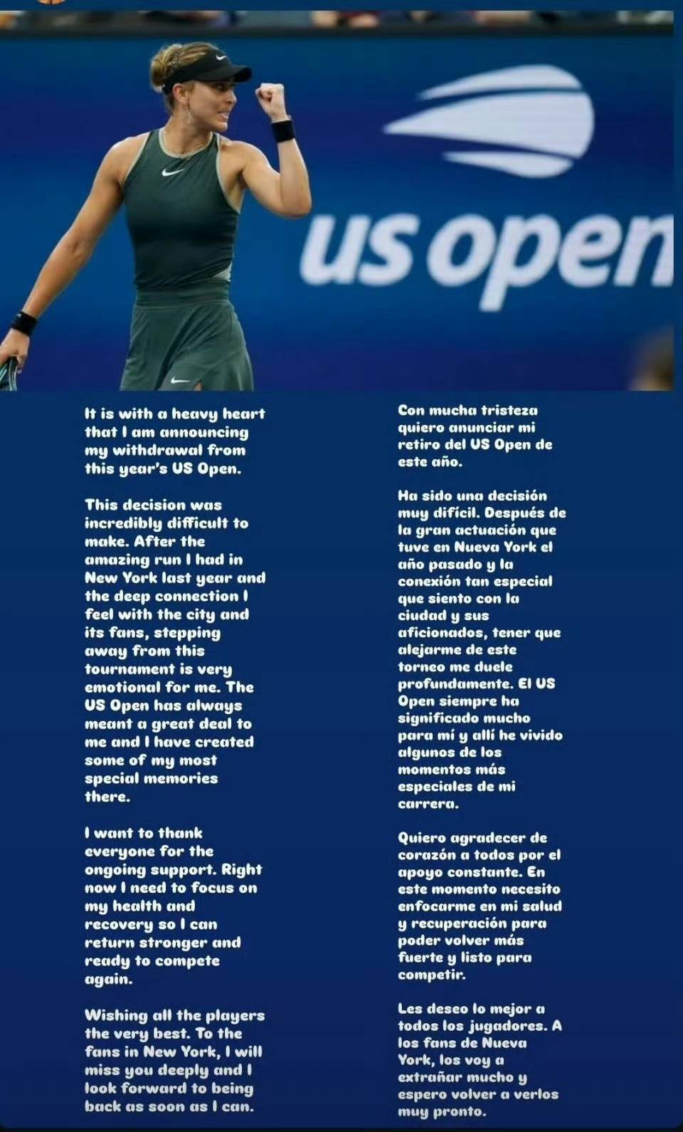 尔特人的抢 尔特人的抢